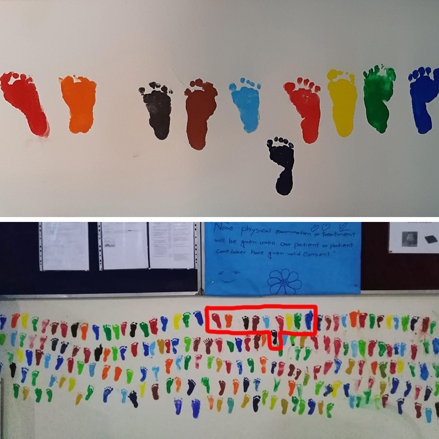 The beautiful reason why this hospital wall is painted with tiny footprints MSF UK